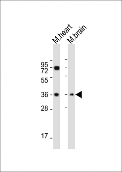 HUMAN-LDHB(Y240) Antibody