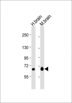 GLS Antibody (N-Term)