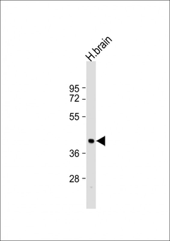 ARRB2 Antibody (C-Term)