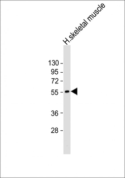 CHRM4 Antibody (C-Term)