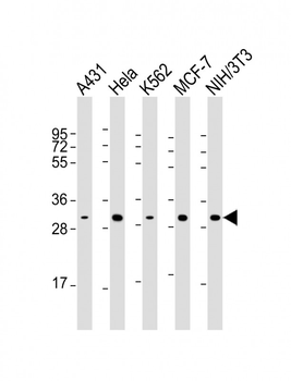 CDK4 Antibody [Knockout Validated]
