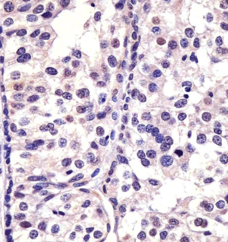 CDK4 Antibody [Knockout Validated]