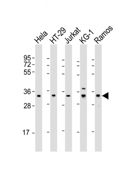 SPPL2B Antibody (N-Term)