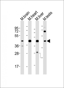 (Mouse) Utf1 Antibody (C-term)