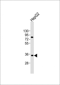AKR7L Antibody (N-Term)