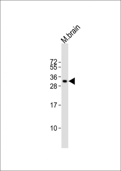 PPP1R1B Antibody (Center)