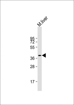 AKR7L Antibody (Center)
