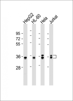 AKR7L Antibody (Center)