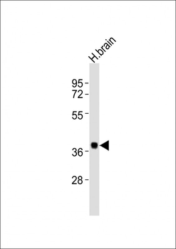 SH3GL3 Antibody (C-term)