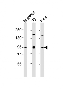 SUZ12 Antibody (Center)