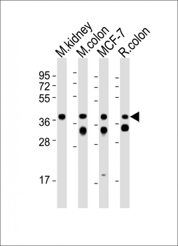 (Mouse) Epcam Antibody (C-term)