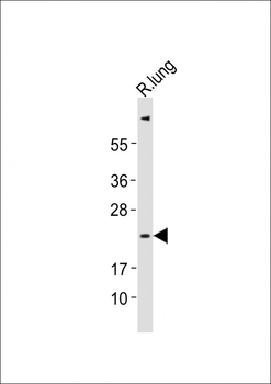 (Mouse) Ctf1 Antibody