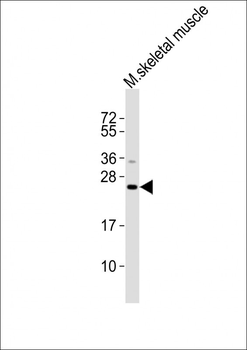 (Mouse) Ctf1 Antibody