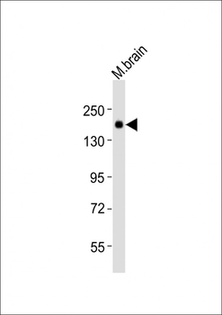 (Mouse) Jag1 Antibody (C-term)