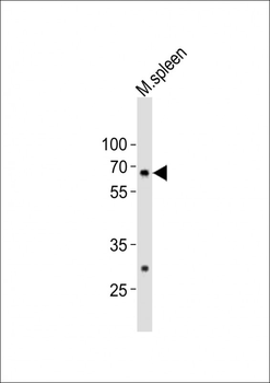 (Mouse) Gnl3 Antibody (C-term)