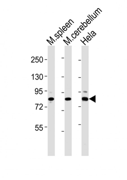 Suz12 Antibody (Center)