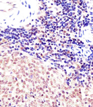 Suz12 Antibody (Center)
