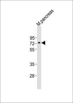 Mouse Nr4a2 Antibody (Center)
