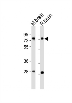 Mouse Nr4a2 Antibody (Center)