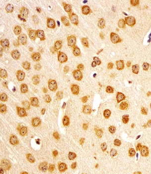 Mouse Nr4a2 Antibody (Center)