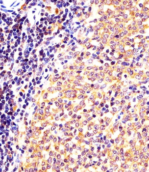 Mouse Nr4a2 Antibody (Center)