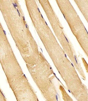 CHST1 Antibody (C-term)