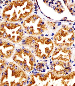 LAMP1 Antibody [Knockout Validated]