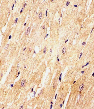 Med15 Antibody (C-term)