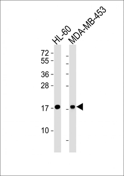 FHIT Antibody