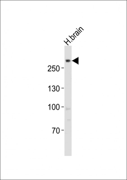 LRRK2 Antibody (C-term)