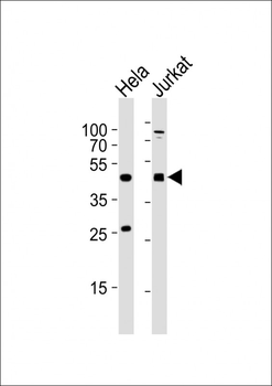 AVPR2 Antibody (C-term)