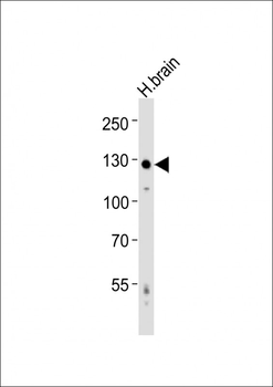 AMPH Antibody (Center)
