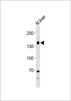 TSHR Antibody (Center)
