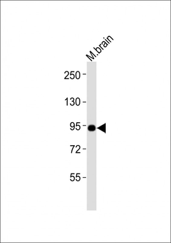 Mouse Epc1 Antibody (Center)