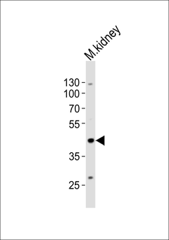 PDGFD Antibody