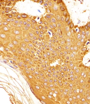 SNCA Antibody (C-term)