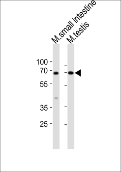 Mouse Klf4 Antibody (Center)