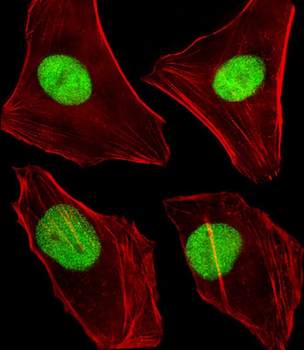 (Mouse) Dnmt1 Antibody (Center)