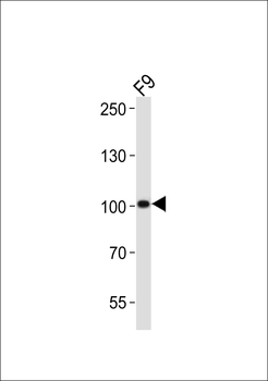 Mouse Suz12 Antibody (Center)