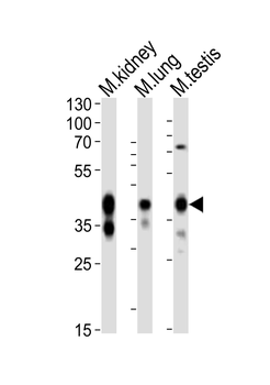 (Mouse) Epcam Antibody (C-term)