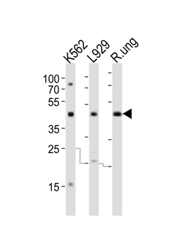TGFB1 Antibody