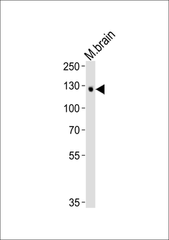 Tyro3 Antibody
