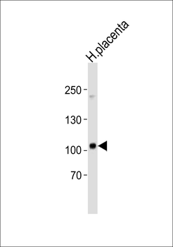 ENG Antibody (Center)