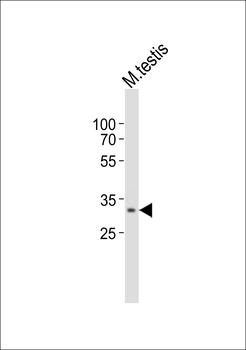 TOMM34 Antibody (Center)