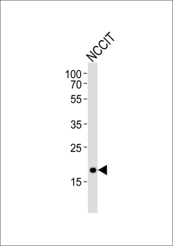 Hmga2 Antibody (N-term)