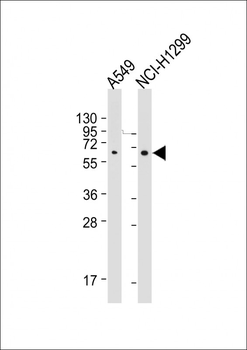 SQSTM1 Antibody