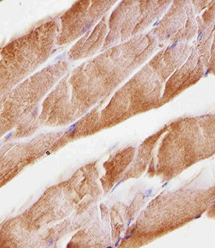 Musk Antibody