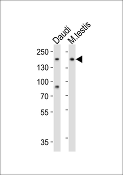 FLT3 Antibody (Center)