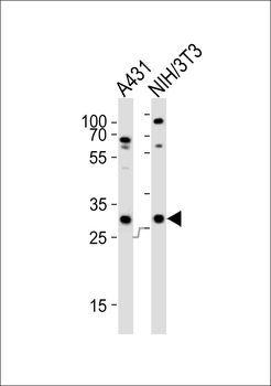 CDK5 Antibody (C-term)