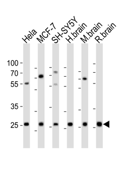 NTF3 Antibody (Center)
